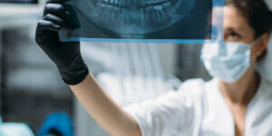 Wisdom Teeth Extraction Wisdom Teeth Extraction