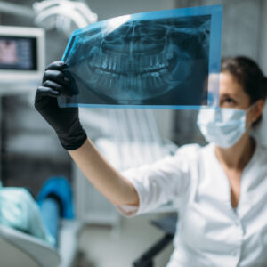 Wisdom Teeth Extraction