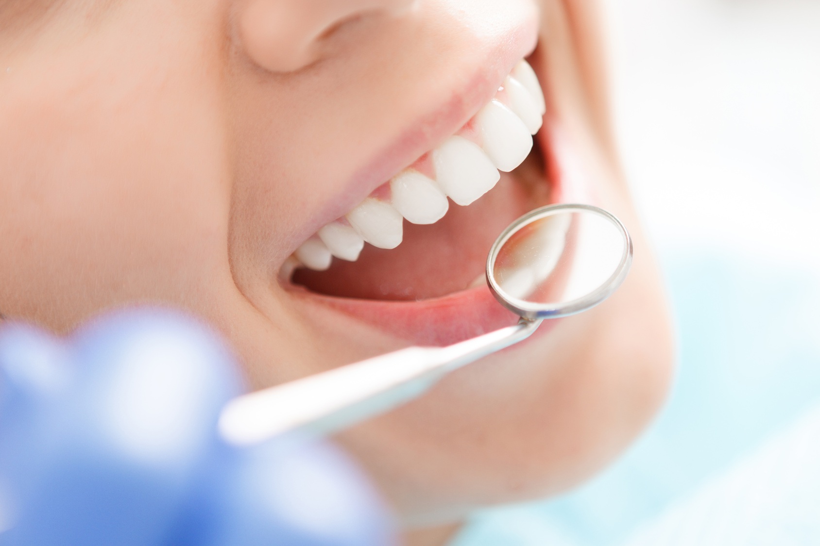 Dental Crowns & Bridges in London Ontario 4 Bright smile checked with a dental mirror after crown and bridge treatment