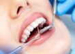 Dental in London