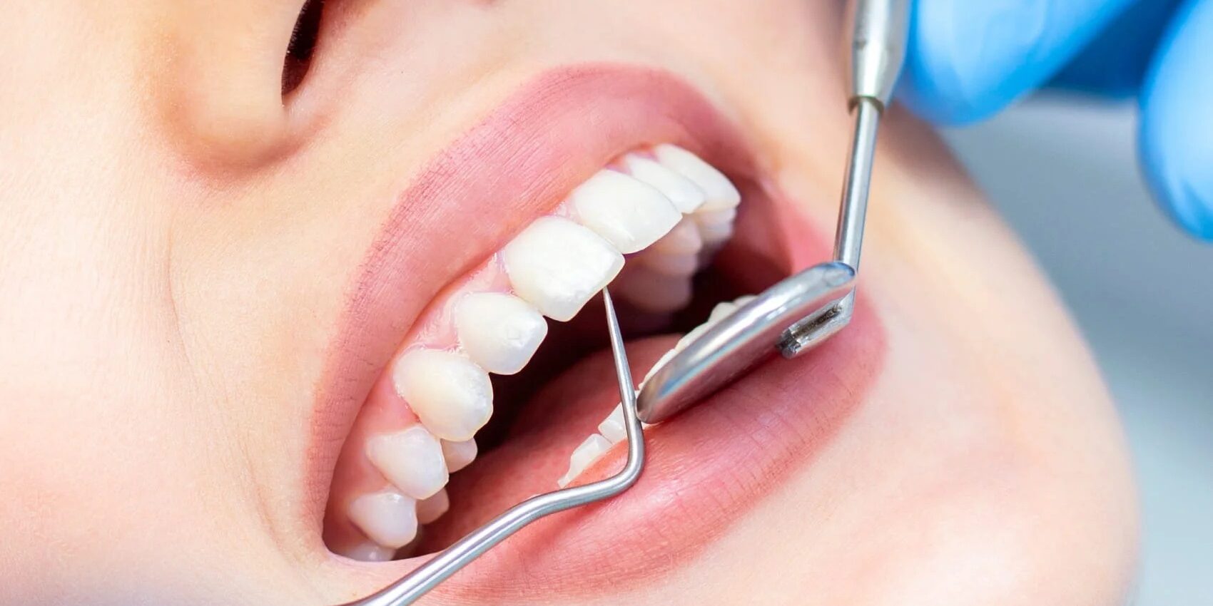 Dental in London Dental in London