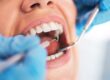 Dental Near Me