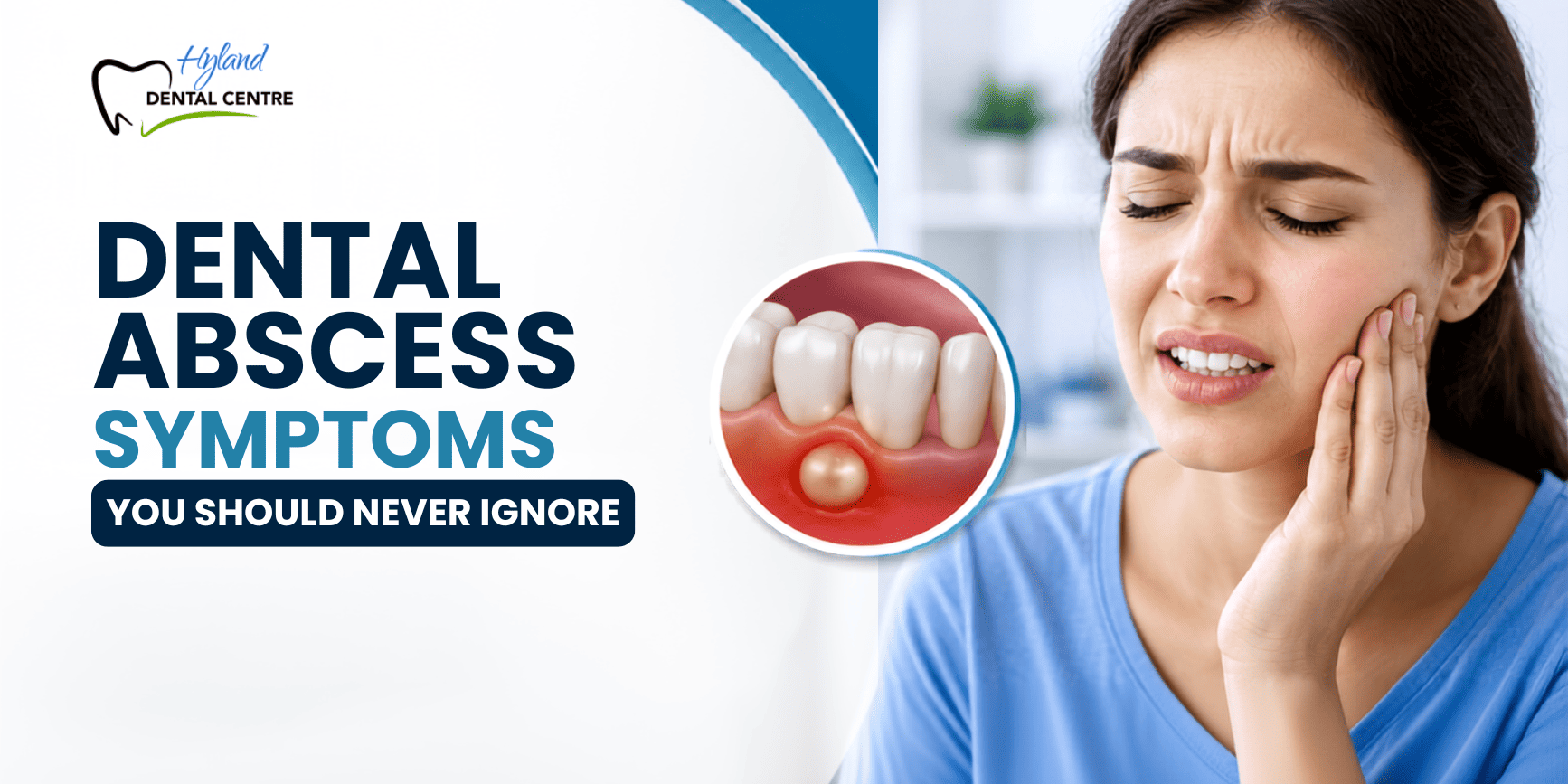 Dental abscess symptoms and emergency dental care at Hyland Dental Centre in London, Ontario