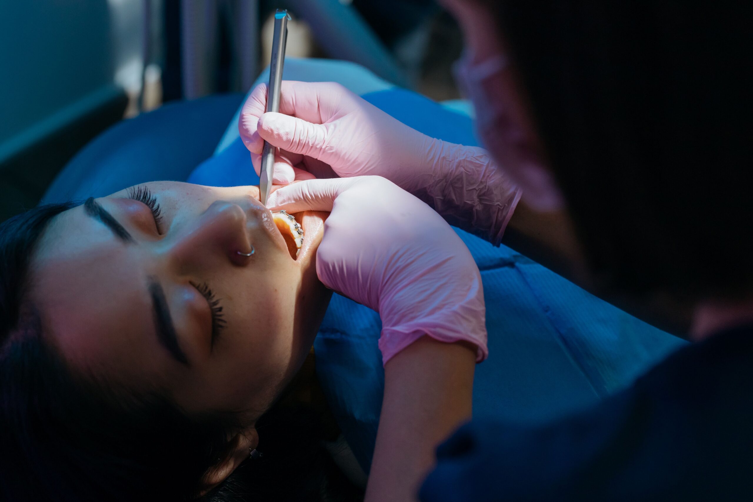 What is sedation dentistry? Is it safe? 3 Patient relaxed in the dental chair during treatment in London, Ontario